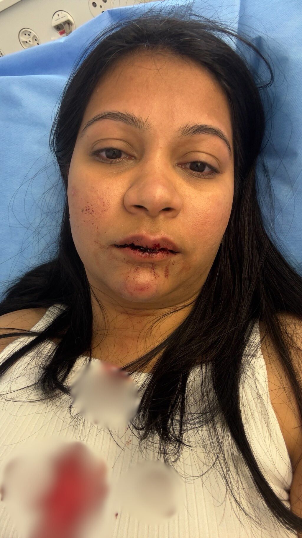 Nikata said her teeth were damaged in an alleged attack. (Nikita and Karan)