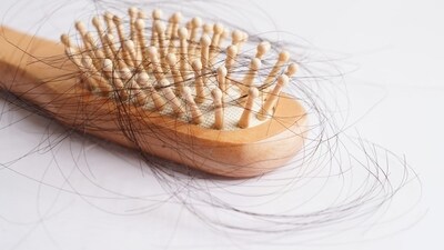 Anti hair fall serums (Shutterstock) Anti hair fall serums (Shutterstock)