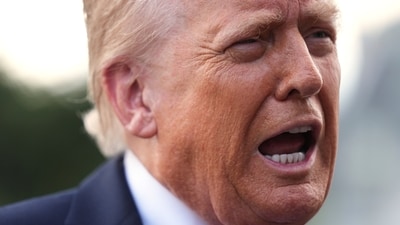President Donald Trump has, in the past, been seen with a bruise on his hand, sparking health concerns. (AP) President Donald Trump has, in the past, been seen with a bruise on his hand, sparking health concerns. (AP)