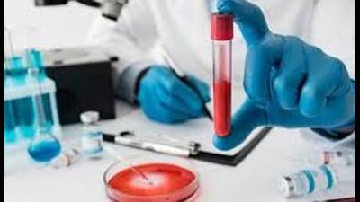 According to KGMU prof Ved Prakash, more than half of the patients in the intensive care unit of KGMU’s pulmonary department are suffering from sepsis. (For Representation) According to KGMU prof Ved Prakash, more than half of the patients in the intensive care unit of KGMU’s pulmonary department are suffering from sepsis. (For Representation)
