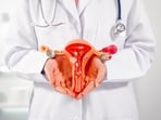 PCOS is increasingly prevalent among young Indian women, driven by lifestyle factors like poor diet and inactivity. 