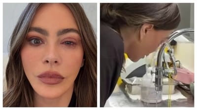 Sofia Vergara missed the Emmys due to an eye emergency that flared up while she was in the car. (PC: IG/@sofiavergara) Sofia Vergara missed the Emmys due to an eye emergency that flared up while she was in the car. (PC: IG/@sofiavergara)