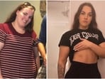 From binge eating to balance: Emma shares her 72 kg weight loss transformation. 