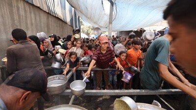 In the last 24 hours, three more Palestinians have died of malnutrition and starvation, according to the Gaza health ministry, with the total deaths now at 428. (AFP) In the last 24 hours, three more Palestinians have died of malnutrition and starvation, according to the Gaza health ministry, with the total deaths now at 428. (AFP)
