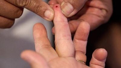 A drop of blood is drawn to measure glucose levels and screen for diabetes during a health clinic (AP FILE PHOTO) A drop of blood is drawn to measure glucose levels and screen for diabetes during a health clinic (AP FILE PHOTO)
