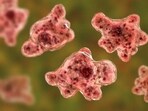 Primary amoebic meningoencephalitis (PAM) is a disease caused usually by infection with Naegleria fowleri, a microscopic amoeba commonly called a "brain-eating amoeba." Primary amoebic meningoencephalitis (PAM) is a disease caused usually by infection with Naegleria fowleri, a microscopic amoeba commonly called a "brain-eating amoeba."