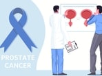 Prostate cancer is a type of cancer that occurs in the prostate gland, a small walnut-sized gland in men. (Freepik) Prostate cancer is a type of cancer that occurs in the prostate gland, a small walnut-sized gland in men. (Freepik)