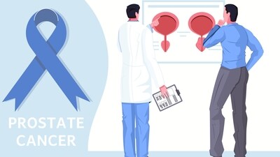 Prostate cancer is a type of cancer that occurs in the prostate gland, a small walnut-sized gland in men. (Freepik) Prostate cancer is a type of cancer that occurs in the prostate gland, a small walnut-sized gland in men. (Freepik)