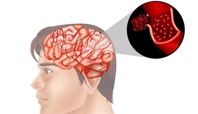 Naegleria fowleri, the brain-eating amoeba, has caused multiple fatalities in Kerala, with cases rising to 67 and 18 deaths. (Freepik) Naegleria fowleri, the brain-eating amoeba, has caused multiple fatalities in Kerala, with cases rising to 67 and 18 deaths. (Freepik)