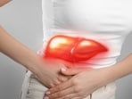 Dr Cyriac Abby Philips shared a case of a 14-year-old girl and said she suffered severe liver damage due to Ayurvedic treatment for epilepsy. (Representative picture: Adobe Stock)