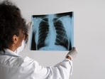 Your diet plays a big role in how well your lungs fight pollution, infections, and even ageing. 