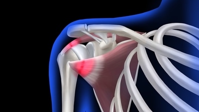 According to the physiotherapist, clicking sounds in your shoulder joints are usually harmless. (Pixabay) According to the physiotherapist, clicking sounds in your shoulder joints are usually harmless. (Pixabay)