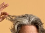 Increasingly, people in their 20s and 30s are experiencing premature greying of hair. 