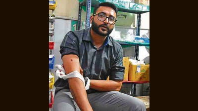 Banker Vishal Bansal getting medical treatment at the civil hospital in Ludhiana on Thursday evening after sustaining a bullet injury in his hand. (Gurpreet Singh/HT) Banker Vishal Bansal getting medical treatment at the civil hospital in Ludhiana on Thursday evening after sustaining a bullet injury in his hand. (Gurpreet Singh/HT)