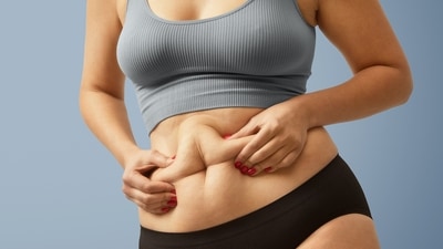 Spot reduction of fat is not biologically possible. (Freepik) Spot reduction of fat is not biologically possible. (Freepik)