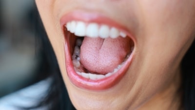 Did you know that an average of 80 million bacteria is transferred during an intimate kiss lasting even 10 seconds? (Shutterstock) Did you know that an average of 80 million bacteria is transferred during an intimate kiss lasting even 10 seconds? (Shutterstock)