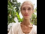 At the time of her death, the 27-year-old weighed just 22 kilograms.
At the time of her death, the 27-year-old weighed just 22 kilograms.
