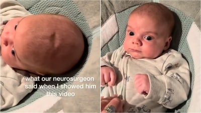 Neurosurgeon reveals baby's skull issue linked to healing process. (Instagram/@casitruesdelle) Neurosurgeon reveals baby's skull issue linked to healing process. (Instagram/@casitruesdelle)
