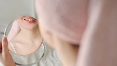 According to Dr Waraich, acne is not just a teenage concern. (Unsplash) According to Dr Waraich, acne is not just a teenage concern. (Unsplash)