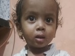 18-month-old in coma after civic-run hospitals turn him away 18-month-old in coma after civic-run hospitals turn him away