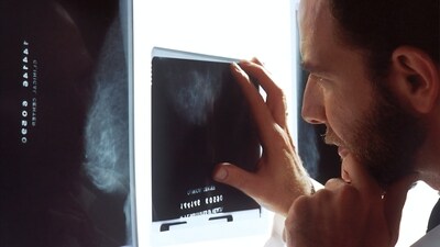 Regular prostate screenings are crucial for men over 40, according to Dr De. (Unsplash) Regular prostate screenings are crucial for men over 40, according to Dr De. (Unsplash)