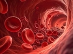 Advanced lab tests often reveal heart conditions that are not detected in standard lipid profiles.