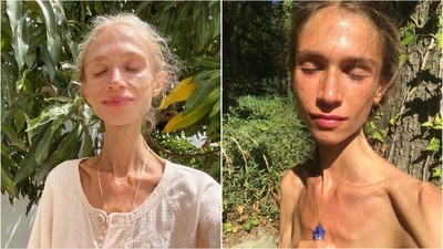Fruit-only diets can lead to severe malnutrition and long-term health issues, doctors say. (Instagram/@carolina.mariie) Fruit-only diets can lead to severe malnutrition and long-term health issues, doctors say. (Instagram/@carolina.mariie)