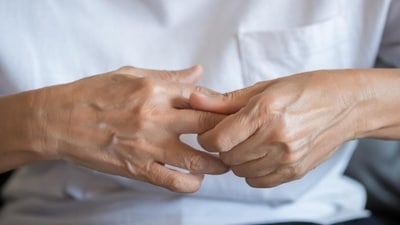 What food and drinks should I avoid with arthritis? (Adobe Stock) What food and drinks should I avoid with arthritis? (Adobe Stock)