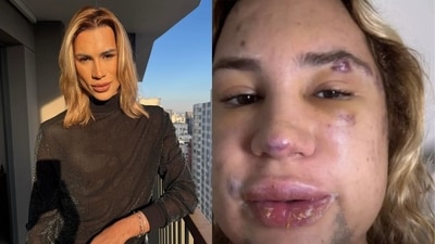 Tragic death of influencer highlights risks of cosmetic procedures. Tragic death of influencer highlights risks of cosmetic procedures.