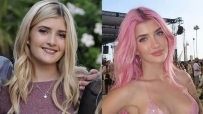 From lip fillers to nose jobs: Sami Sheen shares her cosmetic surgery experience on social media. (Instagram/@samisheen) From lip fillers to nose jobs: Sami Sheen shares her cosmetic surgery experience on social media. (Instagram/@samisheen)