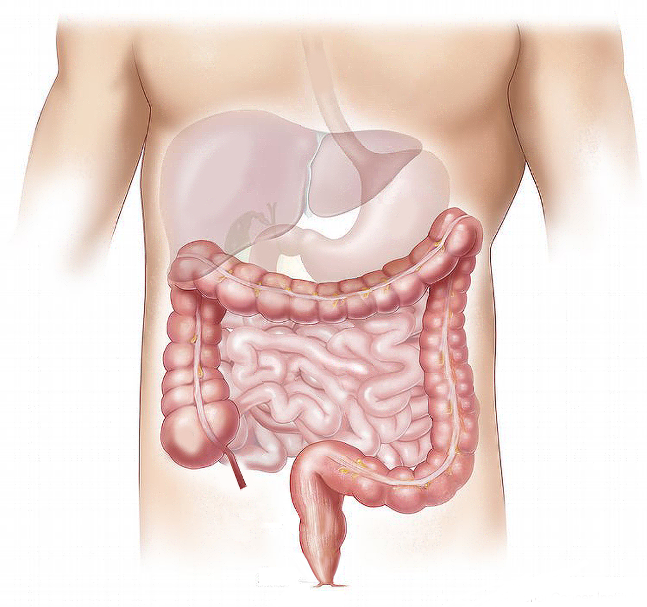 According to Dr Sethi, persistent changes in bowel consistency and movements can be an early warning sign of colon cancer. (Pixabay)