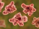 The state is battling the rare and often fatal brain infection caused by the "brain-eating amoeba" Naegleria fowleri. The state is battling the rare and often fatal brain infection caused by the "brain-eating amoeba" Naegleria fowleri.