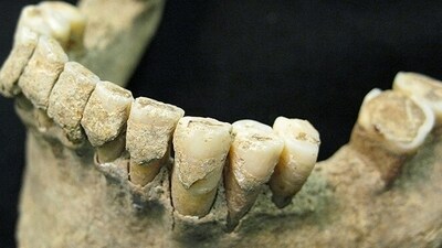 Representative teeth. (University of York.) Representative teeth. (University of York.)
