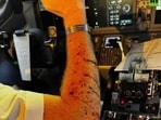 Photo shared on social media of the injured pilot Photo shared on social media of the injured pilot
