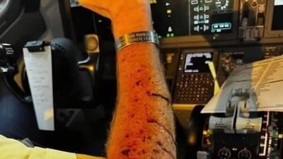 Photo shared on social media of the injured pilot Photo shared on social media of the injured pilot