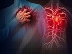 గుండె వైఫల్యం: లక్షణాలు, ప్రమాద కారకాలు, నివారణ చిట్కాలు(Twitter/PsychiatristCNS)