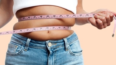 Obesity shows up on your skin in more ways than stretch marks. (Picture credit: Shutterstock) Obesity shows up on your skin in more ways than stretch marks. (Picture credit: Shutterstock)