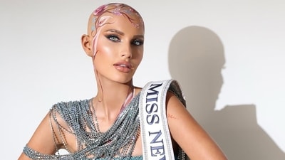 Miss USA contestant Mary Sickler, who has alopecia, removes wig on stage during pageant preliminaries (Instagram/mary_sickler) Miss USA contestant Mary Sickler, who has alopecia, removes wig on stage during pageant preliminaries (Instagram/mary_sickler)