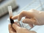 According to officials, the child who was first detected HIV-positive, has had transfusions of around 25 units of blood since he started visiting the blood bank. According to officials, the child who was first detected HIV-positive, has had transfusions of around 25 units of blood since he started visiting the blood bank.
