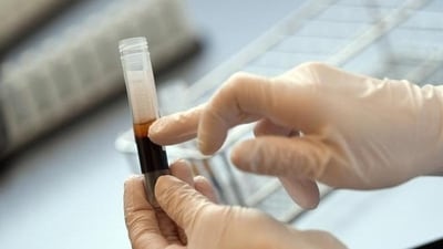 According to officials, the child who was first detected HIV-positive, has had transfusions of around 25 units of blood since he started visiting the blood bank. (Representational Photo/Reuters) According to officials, the child who was first detected HIV-positive, has had transfusions of around 25 units of blood since he started visiting the blood bank. (Representational Photo/Reuters)