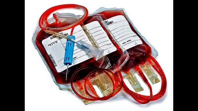According to the officials, of the 373 blood banks registered with the State Blood Transfusion Council (SBTC), 57 (public and private) are in Pune district. (REPRESENTATIVE PHOTO) According to the officials, of the 373 blood banks registered with the State Blood Transfusion Council (SBTC), 57 (public and private) are in Pune district. (REPRESENTATIVE PHOTO)