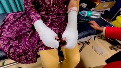A 20-year-old woman sustained burn injuries on her hands after a acid attack by her stalker and his associates near Laxmi Bai College (PTI) A 20-year-old woman sustained burn injuries on her hands after a acid attack by her stalker and his associates near Laxmi Bai College (PTI)