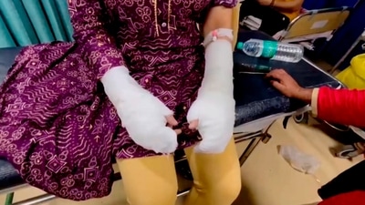 A 20-year-old woman showing her fake injuries at a hospital after alleging acid attack by who she described as her stalker and his associates near Laxmi Bai College of Delhi (PTI) A 20-year-old woman showing her fake injuries at a hospital after alleging acid attack by who she described as her stalker and his associates near Laxmi Bai College of Delhi (PTI)