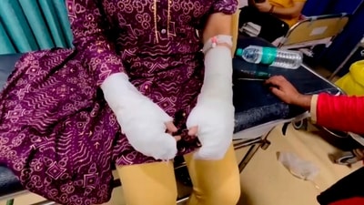 A 20-year-old woman showing her fake injuries at a hospital after alleging acid attack by who she described as her stalker and his associates near Laxmi Bai College of Delhi (PTI)