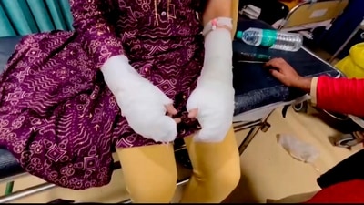 The woman, a student of DU’s School of Open Learning, had initially alleged that three men on a bike threw acid on her while she was walking to college. She was admitted to RML Hospital with burn injuries to her hands. (PTI) The woman, a student of DU’s School of Open Learning, had initially alleged that three men on a bike threw acid on her while she was walking to college. She was admitted to RML Hospital with burn injuries to her hands. (PTI)