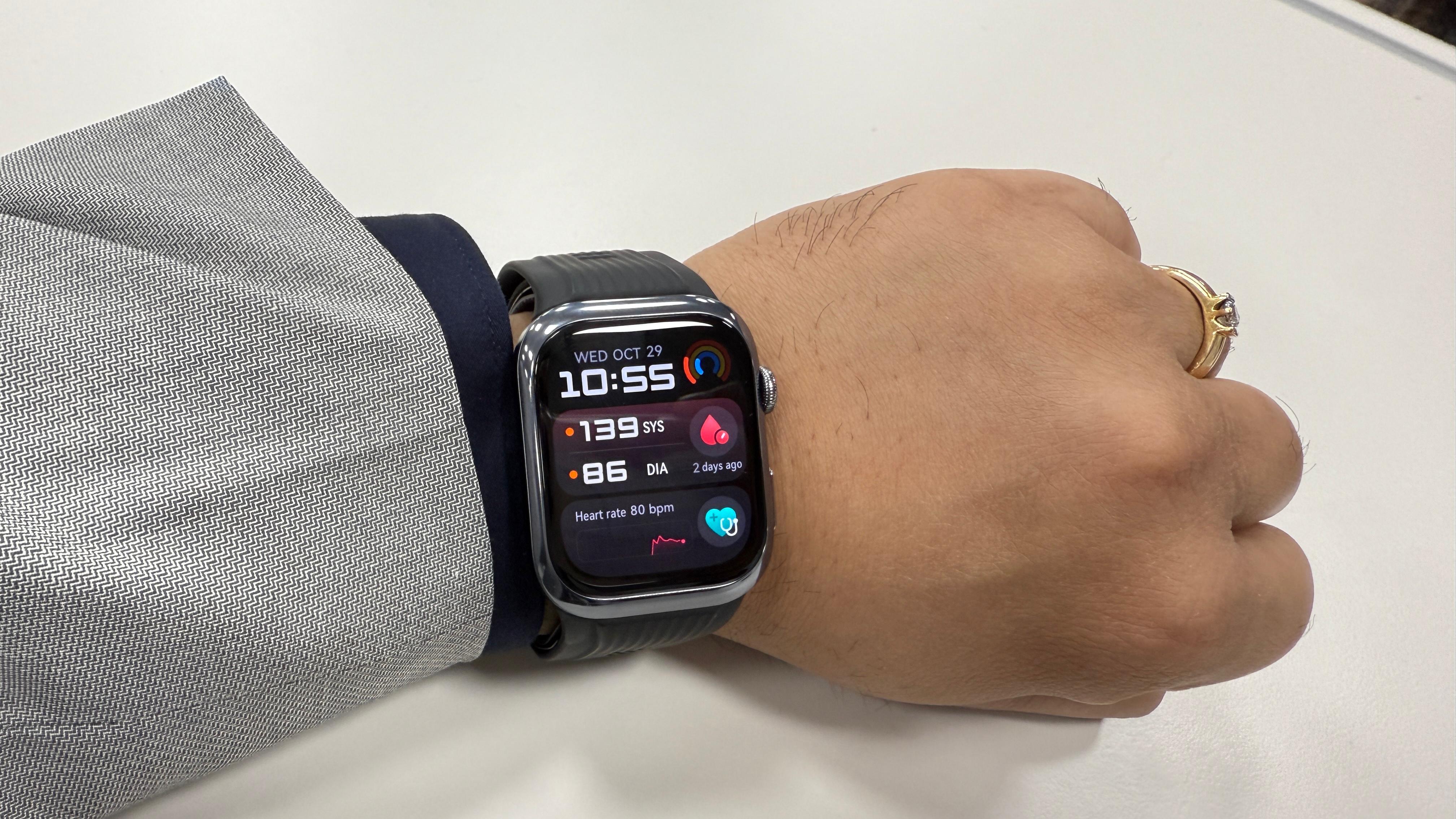 At first glance, the Watch D2 looks polished rather than clinical. (Debashis Sarkar)