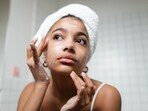 Indians naturally have open pores more. Indians naturally have open pores more.