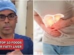 Discover 10 foods that naturally protect and heal your liver health. 