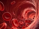 Simple dietary changes like limiting salt intake can lower blood pressure.