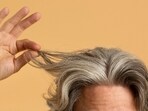 Premature greying? It could be a sign of vitamin B12 deficiency.